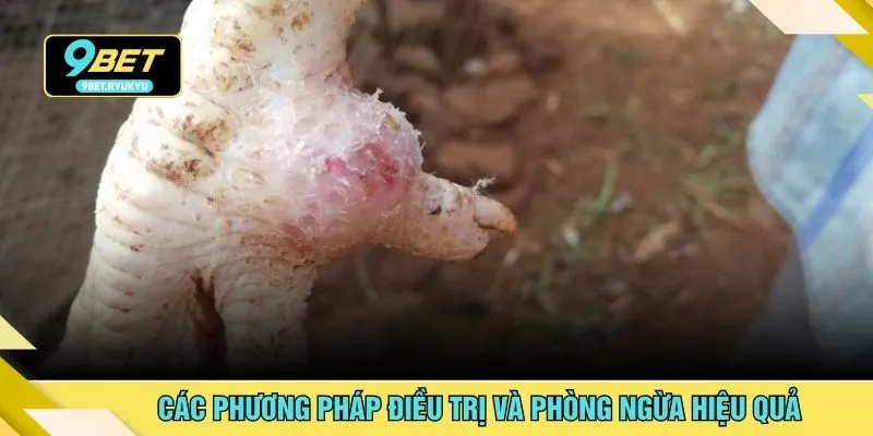 Các phương pháp điều trị và phòng ngừa hiệu quả